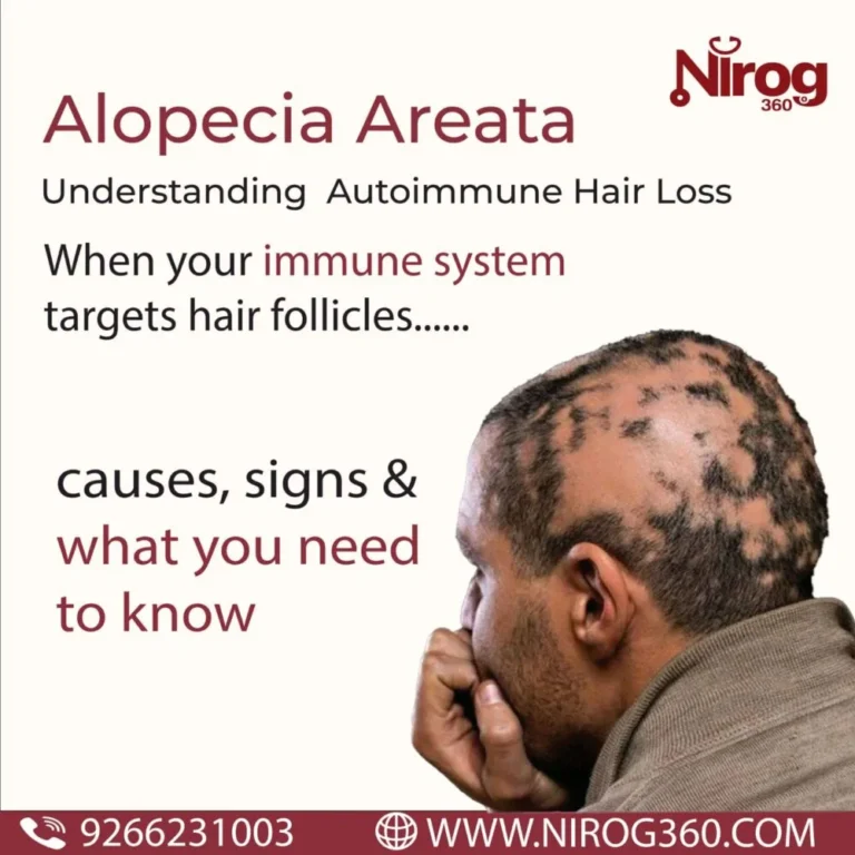 alt="Alopecia Areata patchy hair loss on scalp"